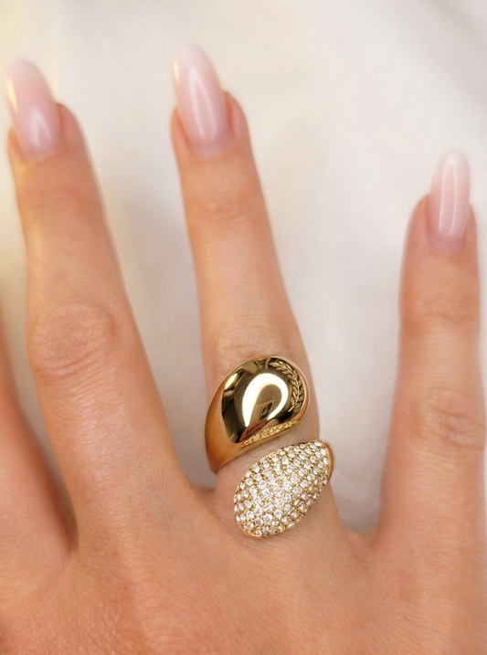 Anello Contraire